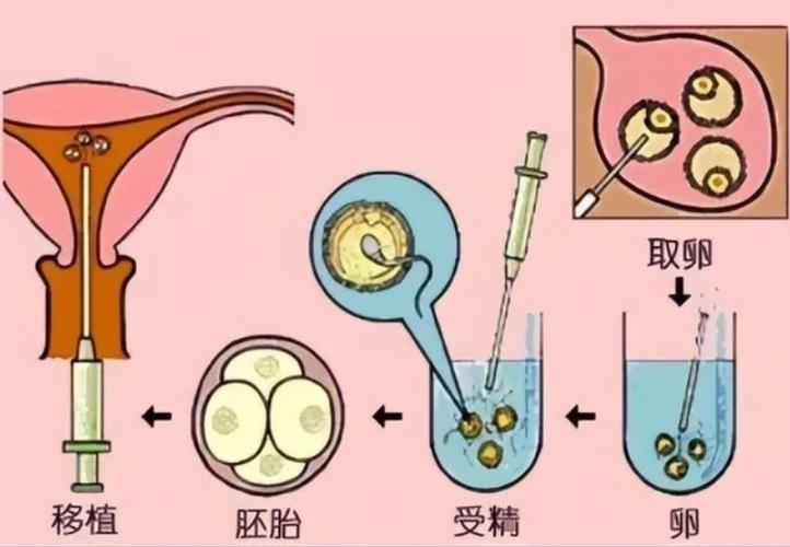 第三代供卵试管宝宝叹气是什么原因